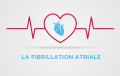 Infographie en vidéo sur la Fibrillation Atriale
