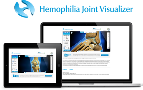 Hemophilia Joint Visualizer